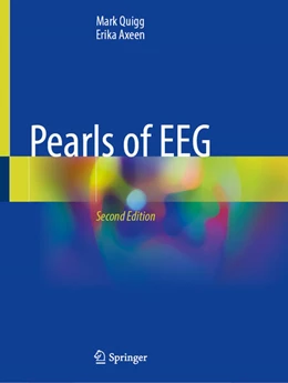 Abbildung von Quigg / Axeen | Pearls of EEG | 2. Auflage | 2025 | beck-shop.de