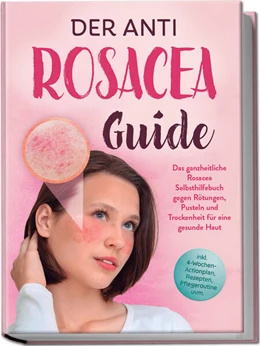Abbildung von Sandkamp | Der Anti Rosacea Guide: Das ganzheitliche Rosacea Selbsthilfebuch gegen Rötungen, Pusteln und Trockenheit für eine gesunde Haut - inkl. 4¿Wochen¿Actionplan, Rezepten, Pflegeroutine uvm. | 1. Auflage | 2025 | beck-shop.de