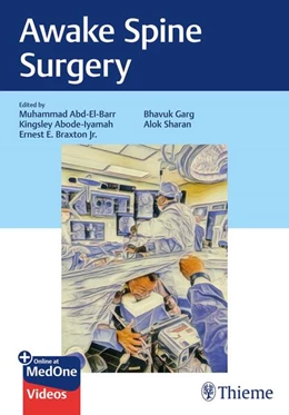 Abbildung von Abd-El-Barr / Sharan | Awake Spine Surgery | 1. Auflage | 2026 | beck-shop.de