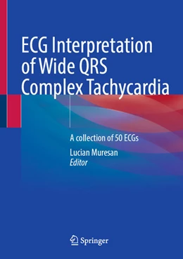 Abbildung von Muresan | ECG Interpretation of Wide QRS Complex Tachycardia | 1. Auflage | 2025 | beck-shop.de