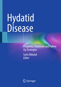 Abbildung von Akbulut | Hydatid Disease | 1. Auflage | 2025 | beck-shop.de