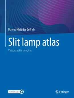 Abbildung von Gellrich | Slit lamp atlas | 1. Auflage | 2025 | beck-shop.de