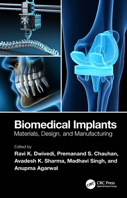 Abbildung von Agarwal / Sharma | Biomedical Implants | 1. Auflage | 2025 | beck-shop.de