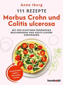 Abbildung von 111 Rezepte - Morbus Crohn und Colitis Ulcerosa | 1. Auflage | 2026 | beck-shop.de