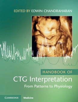 Abbildung von Chandraharan | Handbook of CTG Interpretation | 2. Auflage | 2026 | beck-shop.de