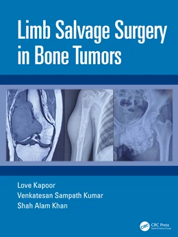 Abbildung von Kapoor / Khan | Limb Salvage Surgery in Bone Tumors | 1. Auflage | 2026 | beck-shop.de