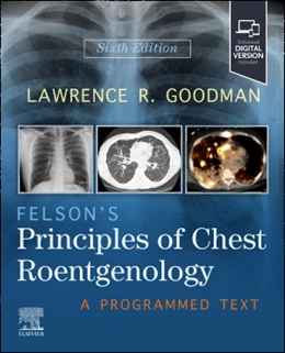 Abbildung von Goodman | Felson's Principles of Chest Roentgenology | 6. Auflage | 2027 | beck-shop.de