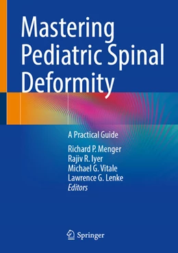 Abbildung von Menger / Iyer | Mastering Pediatric Spinal Deformity | 1. Auflage | 2026 | beck-shop.de