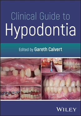 Abbildung von Calvert | Clinical Guide to Hypodontia | 1. Auflage | 2026 | beck-shop.de