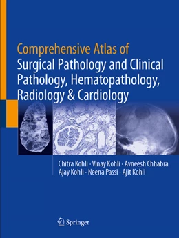 Abbildung von Kohli / Chhabra | Comprehensive Atlas of Surgical Pathology and Clinical Pathology, Hematopathology, Radiology & Cardiology | 1. Auflage | 2025 | beck-shop.de