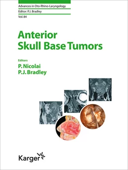Abbildung von Nicolai / Bradley | Anterior Skull Base Tumors | 1. Auflage | 2020 | beck-shop.de