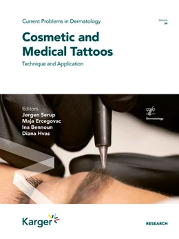 Abbildung von Serup / Ercegovac | Cosmetic and Medical Tattoos | 1. Auflage | 2023 | beck-shop.de