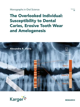 Abbildung von Vieira | The Overlooked Individual: Susceptibility to Dental Caries, Erosive Tooth Wear and Amelogenesis | 1. Auflage | 2022 | beck-shop.de
