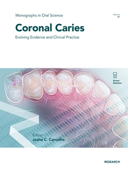 Abbildung von Carvalho | Coronal Caries | 1. Auflage | 2023 | beck-shop.de