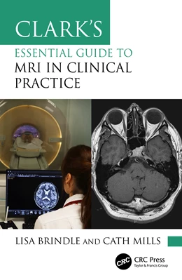 Abbildung von Mills / Brindle | Clark's Essential Guide to MRI in Clinical Practice | 1. Auflage | 2026 | beck-shop.de