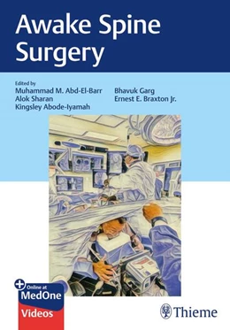 Abbildung von Abd-El-Barr / Sharan | Awake Spine Surgery | 1. Auflage | 2025 | beck-shop.de