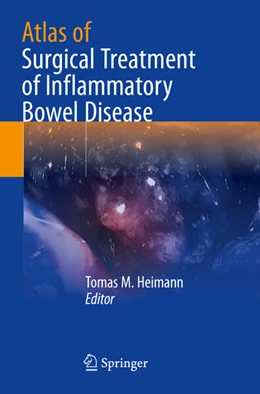 Abbildung von Heimann | Atlas of Surgical Treatment of Inflammatory Bowel Disease | 1. Auflage | 2025 | beck-shop.de
