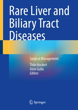 Abbildung von Hackert / Gulla | Rare Liver and Biliary Tract Diseases | 1. Auflage | 2026 | beck-shop.de