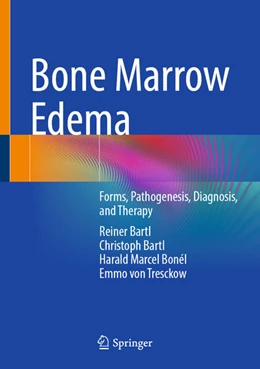Abbildung von Bartl / Bonél | Bone Marrow Edema | 1. Auflage | 2025 | beck-shop.de