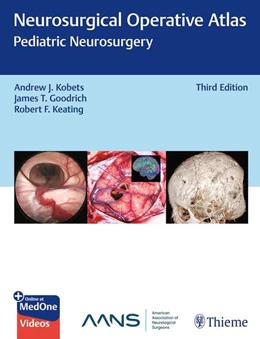 Abbildung von Kobets / Goodrich | Neurosurgical Operative Atlas: Pediatric Neurosurgery | 3. Auflage | 2025 | beck-shop.de