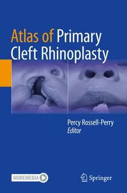 Abbildung von Rossell-Perry | Atlas of Primary Cleft Rhinoplasty | 1. Auflage | 2025 | beck-shop.de