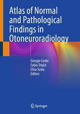 Abbildung von Conte / Triulzi | Atlas of Normal and Pathological Findings in Otoneuroradiology | 1. Auflage | 2026 | beck-shop.de