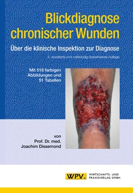 Abbildung von Dissemond | Blickdiagnose chronischer Wunden | 5. Auflage | 2026 | beck-shop.de