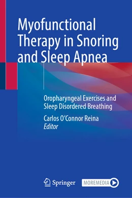 Abbildung von O´Connor Reina | Myofunctional Therapy in Snoring and Sleep Apnea | 1. Auflage | 2026 | beck-shop.de