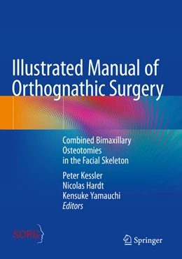 Abbildung von Kessler / Hardt | Illustrated Manual of Orthognathic Surgery | 1. Auflage | 2026 | beck-shop.de