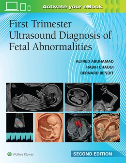 Abbildung von ABUHAMAD / CHAOUI | First Trimester Ultrasound Diagnosis of Fetal Abnormalities | 2. Auflage | 2026 | beck-shop.de