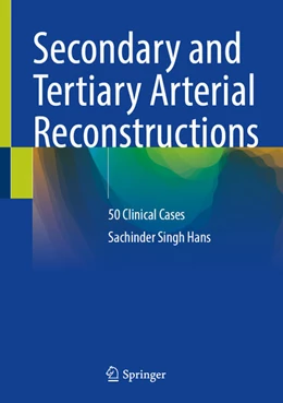 Abbildung von Hans | Secondary and Tertiary Arterial Reconstructions | 1. Auflage | 2026 | beck-shop.de