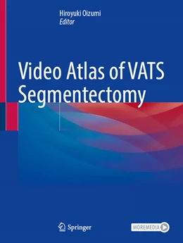 Abbildung von Oizumi | Video Atlas of VATS Segmentectomy | 1. Auflage | 2026 | beck-shop.de