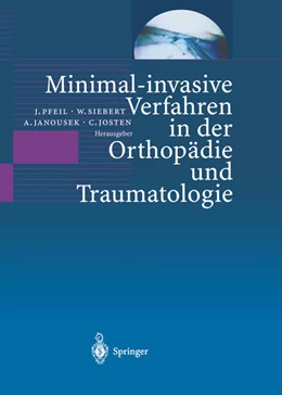 Abbildung von Theobald | Barrieren im strafrechtlichen Wiederaufnahmeverfahren | 1. Auflage | 1998 | beck-shop.de