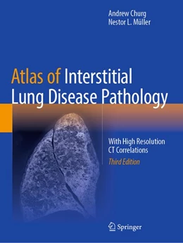 Abbildung von Churg / Müller | Atlas of Interstitial Lung Disease Pathology | 3. Auflage | 2026 | beck-shop.de