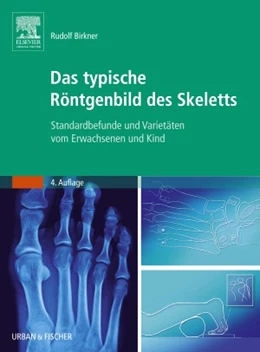 Abbildung von Birkner | Das typische Röntgenbild des Skeletts | 4. Auflage | 2009 | beck-shop.de
