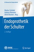 Cover Endoprothetik der Schulter
