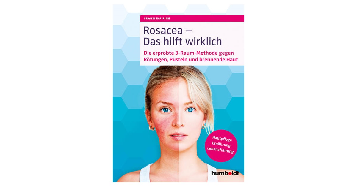 Ring | Rosacea - Das hilft wirklich | 1. Auflage | 2019 | beck-shop.de